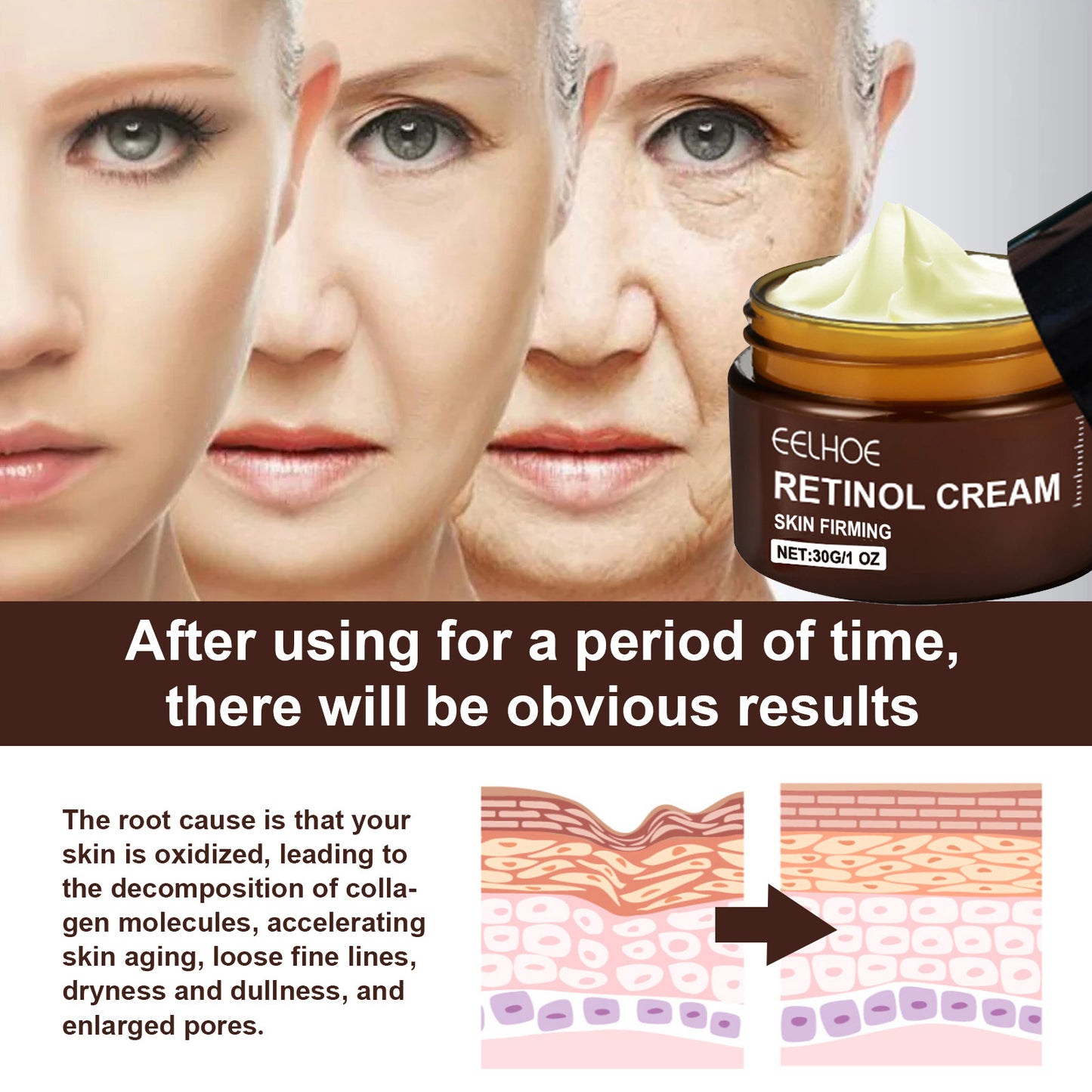 EELHOE Retinol Cream - WildSteam Wellness