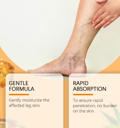 VenoRelief™ Bee Venom Leg Spray – Soothe, Circulate, Restore - WildSteam Wellness