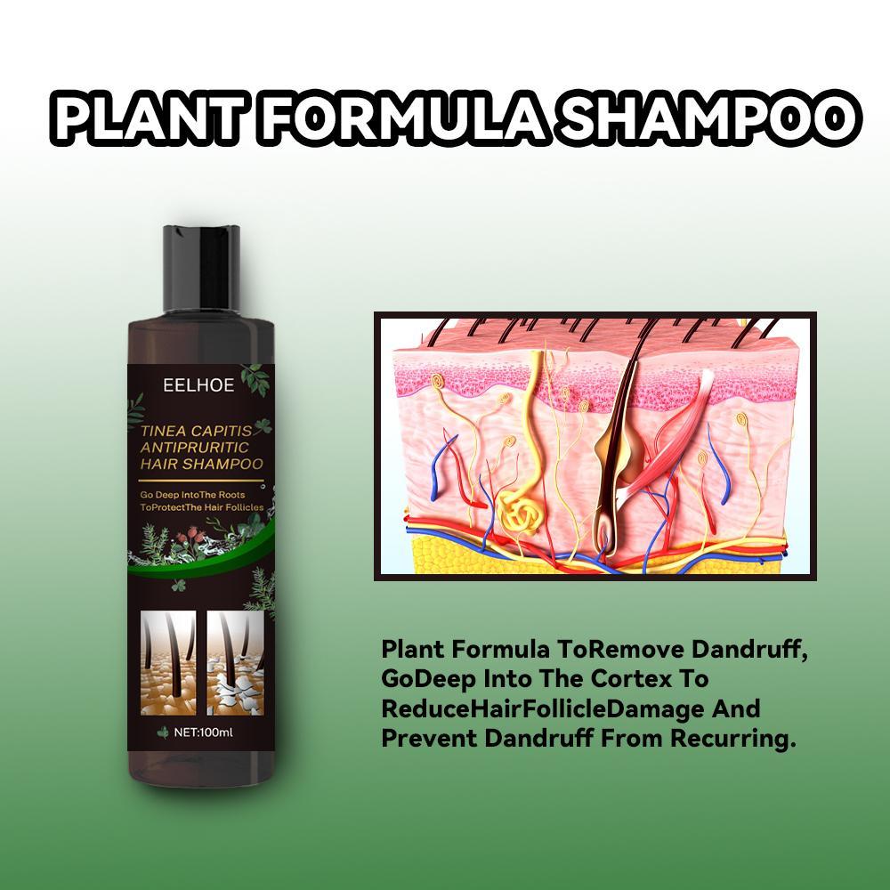 EELHOE™ Anti-Dandruff Shampoo – Soothe, Cleanse & Strengthen Naturally - WildSteam Wellness