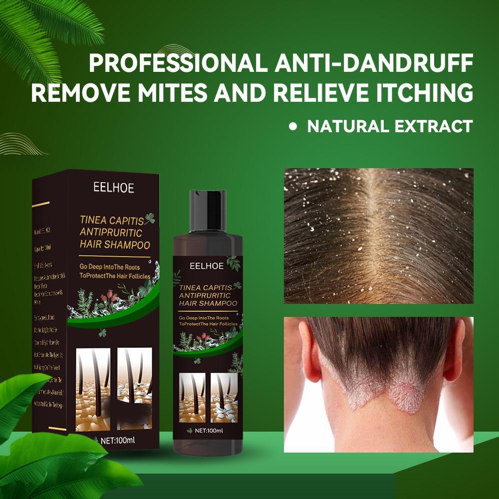 EELHOE™ Anti-Dandruff Shampoo – Soothe, Cleanse &amp; Strengthen Naturally - WildSteam Wellness