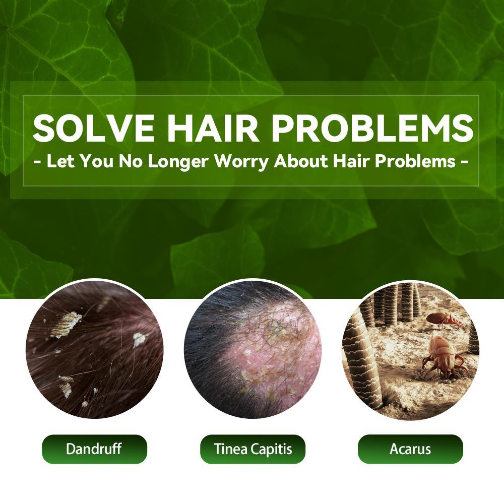 EELHOE™ Anti-Dandruff Shampoo – Soothe, Cleanse &amp; Strengthen Naturally - WildSteam Wellness