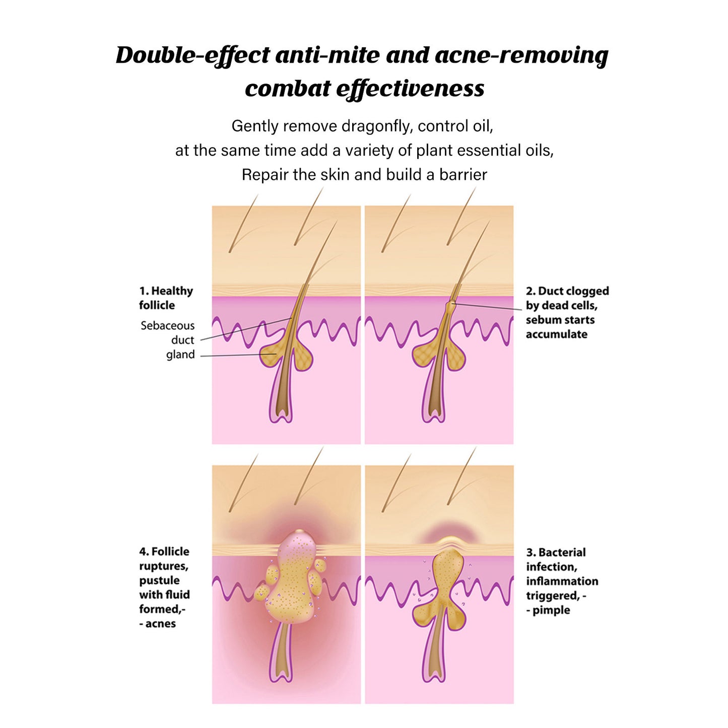 Acne & Mite Relief Soap – Purifying Care with Argan, Avocado & Oatmeal - WildSteam Wellness