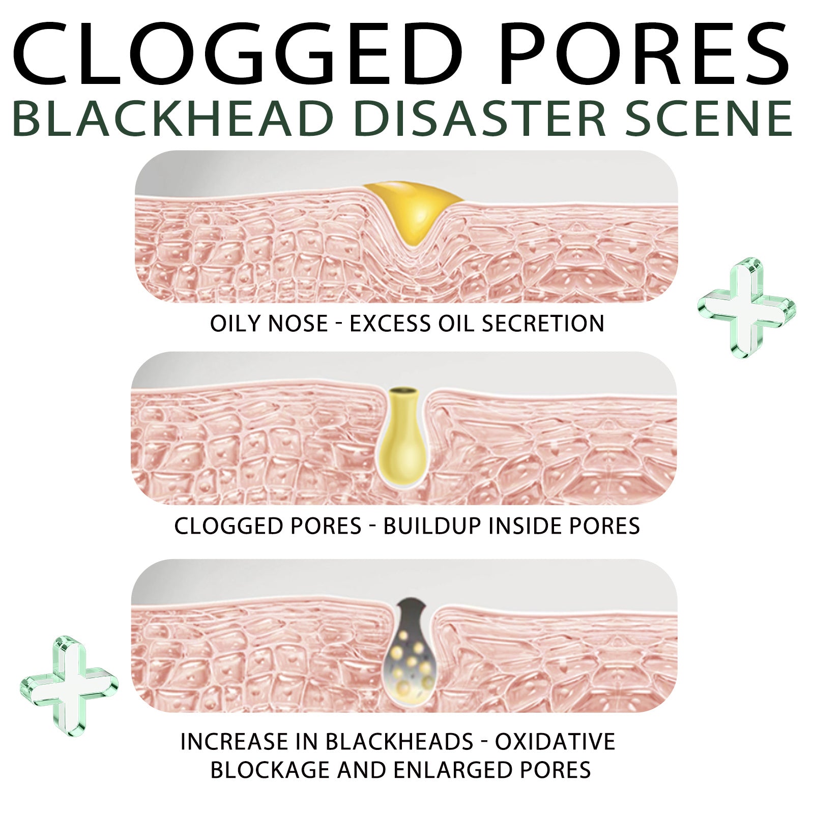 EELHOE ClearSkin™ Blackhead Remover Kit – Detox, Refine, Reveal Radiance - WildSteam Wellness