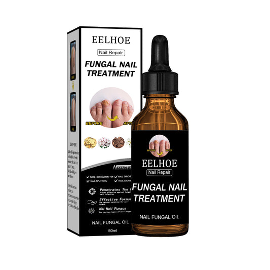 Repair Solution – Strengthen, Protect &amp; Restore Your Nails - WildSteam Wellness